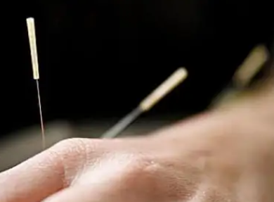 針灸